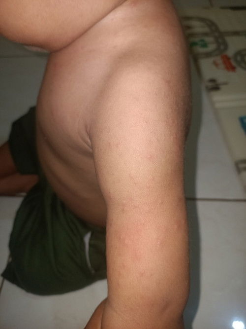 Ga cocok sufor atau intoleransi laktosa?