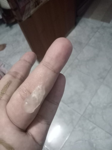 มูกใสๆเเบบนี้ต้องไปโรงบาลเลยมั้ยค่ะ ไม่เจ็บท้อง