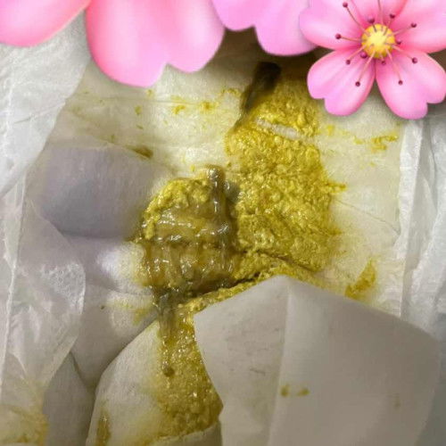 Normal tak najis bayi macam ni? tetiba ada lendir. Sy risau harap momy2 boleh tolong jwb prtnyaan sy