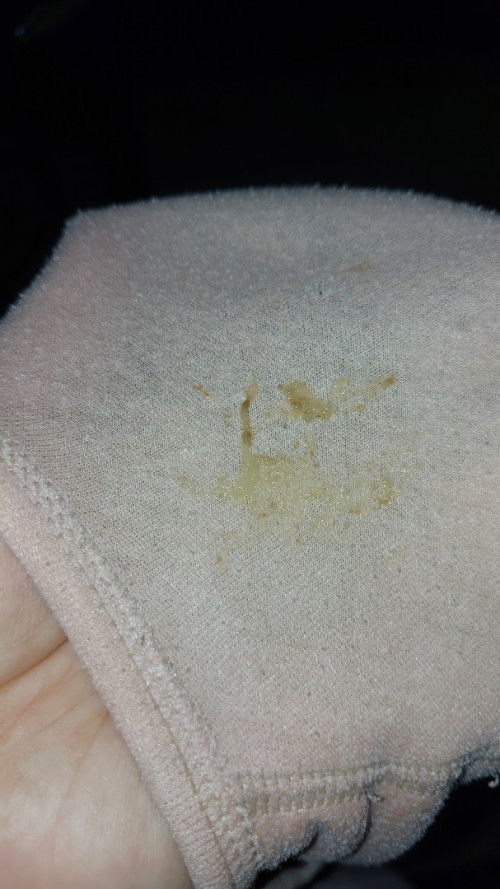 Flek Coklat + Lendir