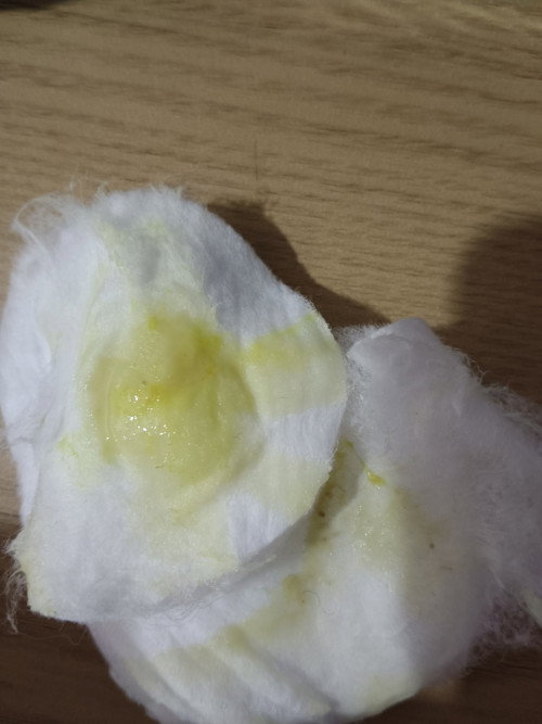 Discaj kuning