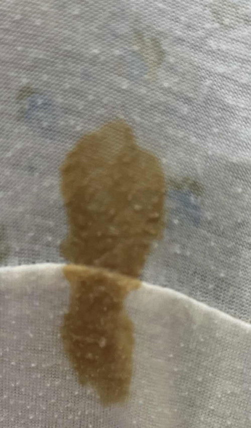 Discharge  may nakaranas po ba ng ganito