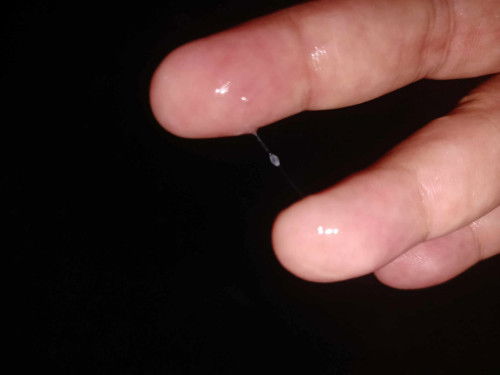 เเบบนี้เรียกตกขาวรึมูกค่ะ