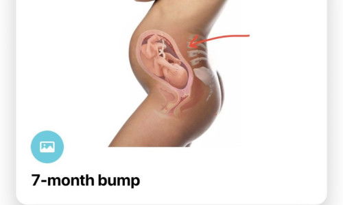 sakit bahagian belakang