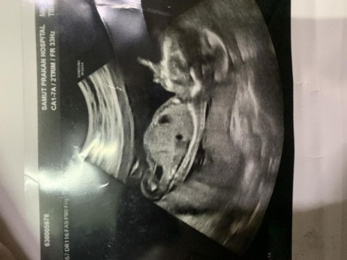 ช่วยดูหน่อยค่ะ