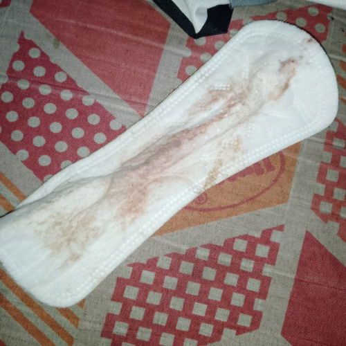 Dark red brown spotting