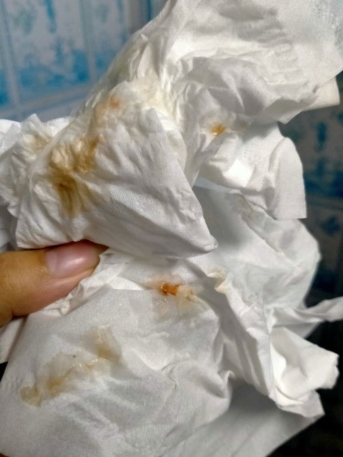 เป็นอีกแล้วค่ะ🥺กังวลเหมือนกันค่ะ#กังลวมากค่ะ แต่ด้วยความไม่มีตังไม่ได้ชะล่าใจนะคะ