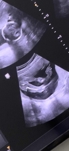 18+6 หมอนัด