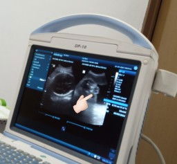 Bertanya soal JK Baby