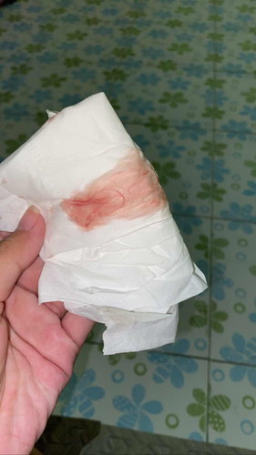 ควรไปหาหมอมั้ยคะ ‼️