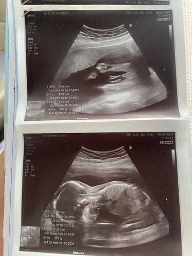 ทำยังไงให้ลูกหันหน้ามา