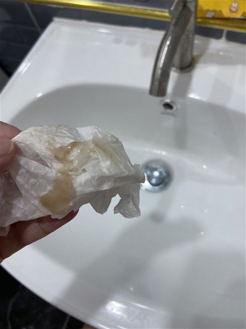 แม่ๆที่มีมูกเลือดออกกี่วันคลอดกันคะ