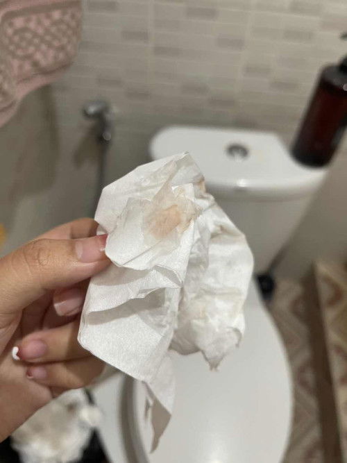 Keputihan atau flek merah saat hamil muda