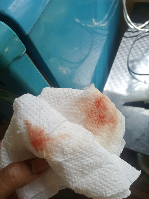 เเบบนี้ควรไปหาหมอเลยไหมคะ