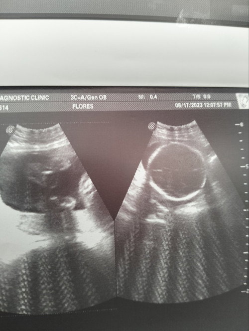 Boy/Girl ano po gender niya sa tingin niyo?