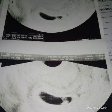 INI KANTUNG KE HAMILAN ATAU BUKAN