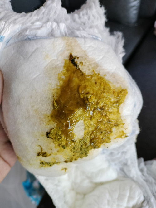 อึลูกมีมูกใส