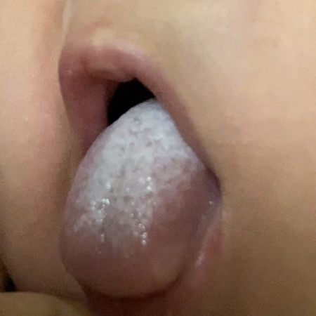 Lidah bayi