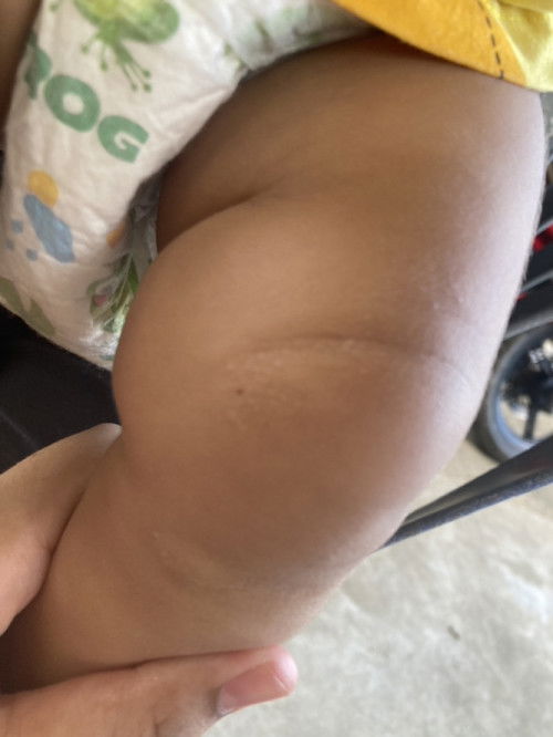 แบบนี้น้องเป็นไรคะ