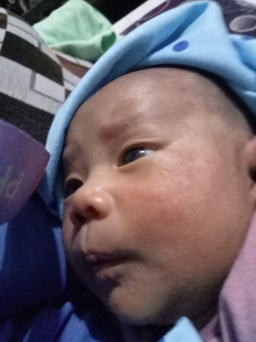 Muka bayi merah bruntusan