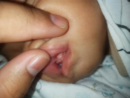 สอบถามแม่ๆ