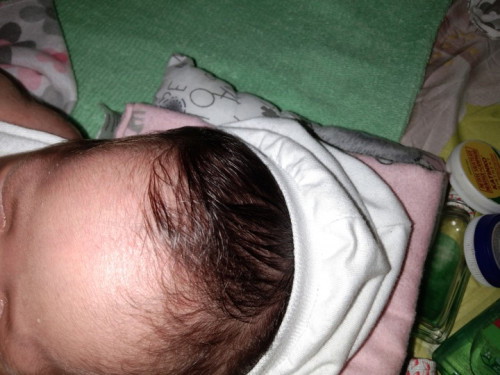 nahlugan ko po ng cp baby ko na 12days.knapa ko prang may biyak sa bndang noo deretso sa ilong.