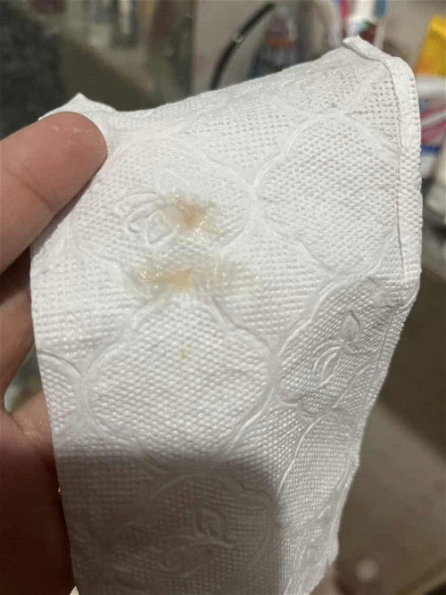 เลือดออกตอนตั้งครรภ์