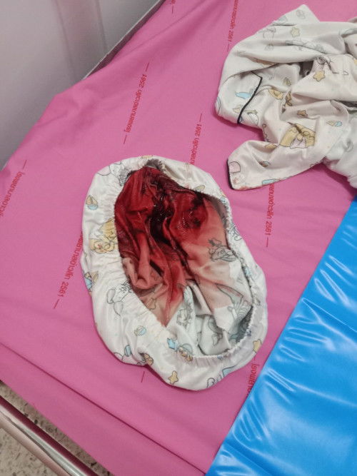 ภาวะรกเกาะต่ำ