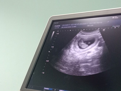 อวดอัลตราซาวลูกกันหน่อย 10+6วีค