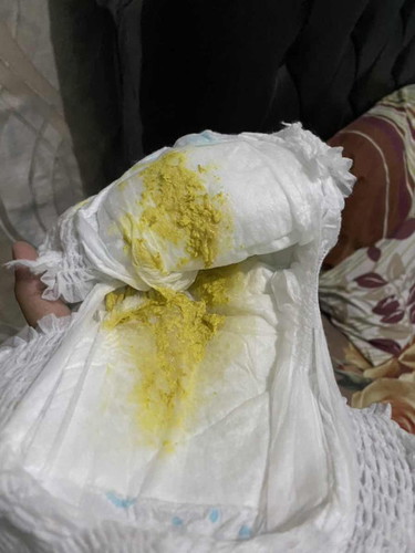 Bayi 3 bulan bab sudah 6x yg warna kuning pucat bab malam jam 2 yg hijau tadi siang jam 11 , knp y?