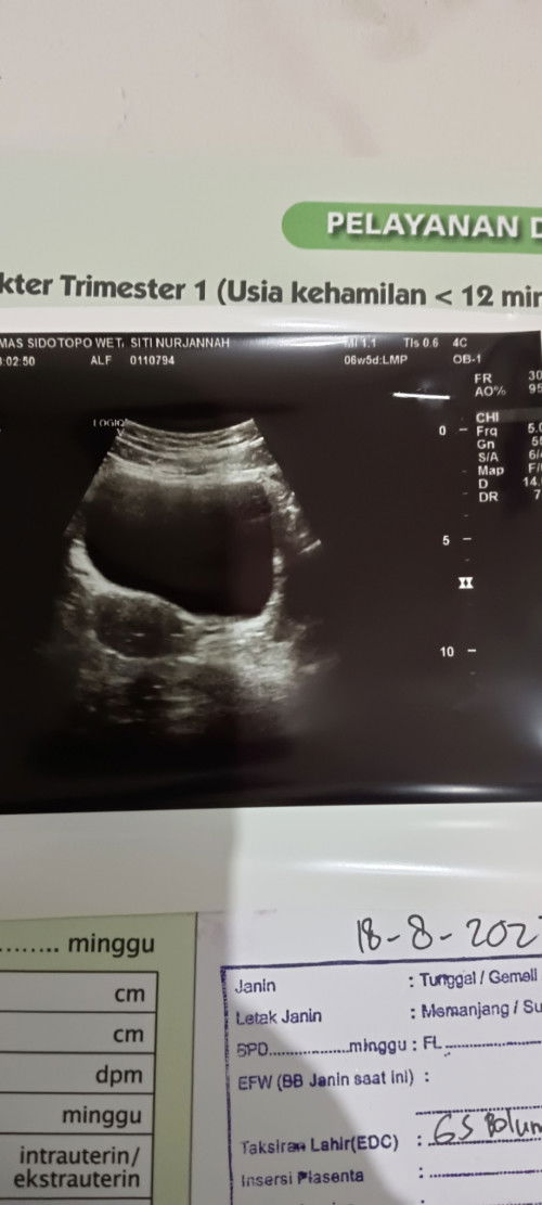 usg 6 minggu