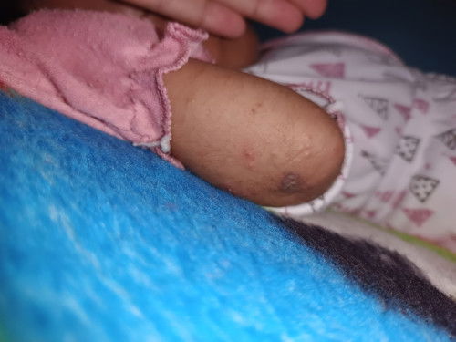 Ini kenapa ya bund . Bayi umur 1 bln