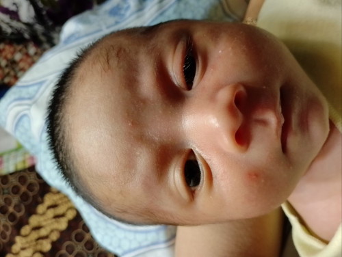 minta sarannya bund