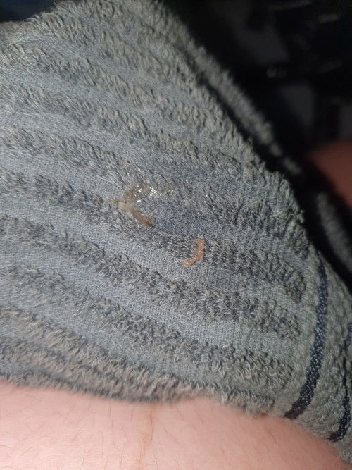 มีมูกเลือดแต่ยังไม่ปวดท้องต้องไปหาหมอเลยหรือว่ารอก่อนคะ