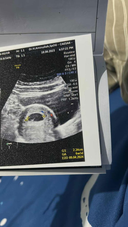 Ada gak kehamilan keluar darah tapi ga banyak