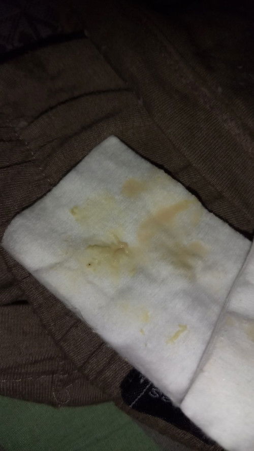 Keputihann banyakk sekali saat usia kehamilan 39 minggu