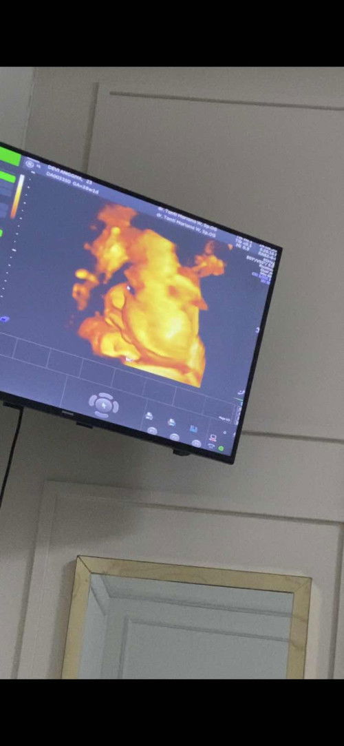 Galau sc atau normal