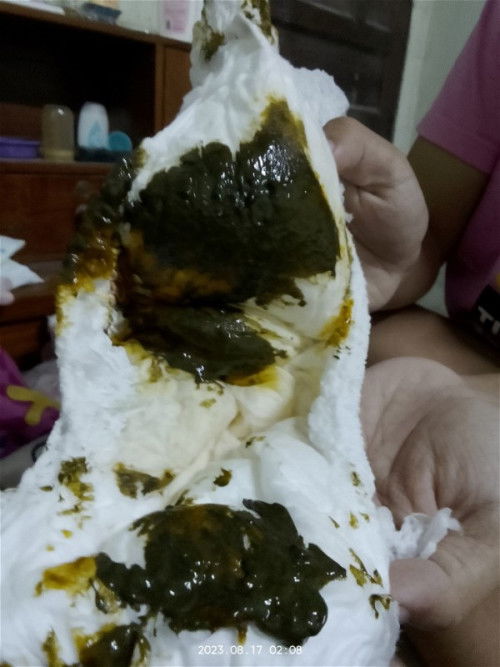 อุจจาระเปนก้อนนุ่มๆ ไม่แข็งง