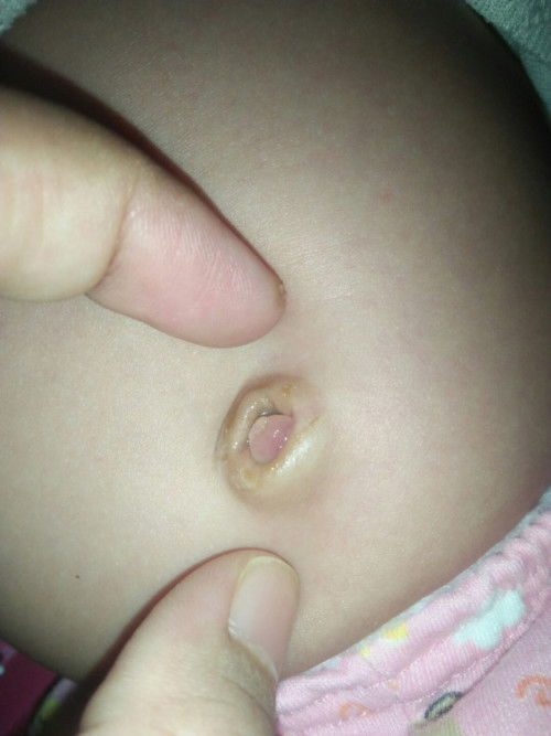 Pusar bayi masih basah