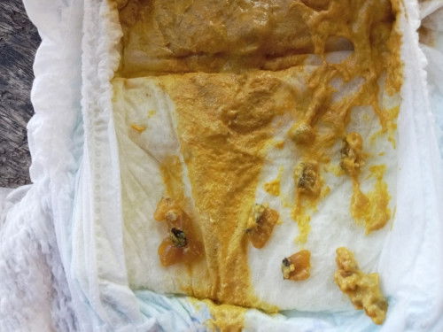 อึแบบนี้ปกติไหมคะ