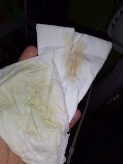 Cairan ketuban atau bukan