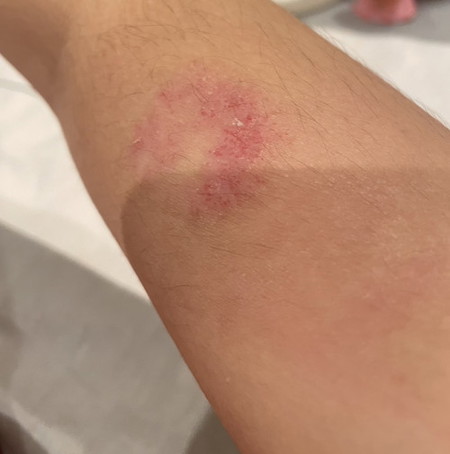 Skin situation