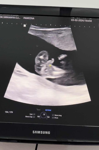 ช่วยดูหน่อยค่ะว่าเพศอะไร