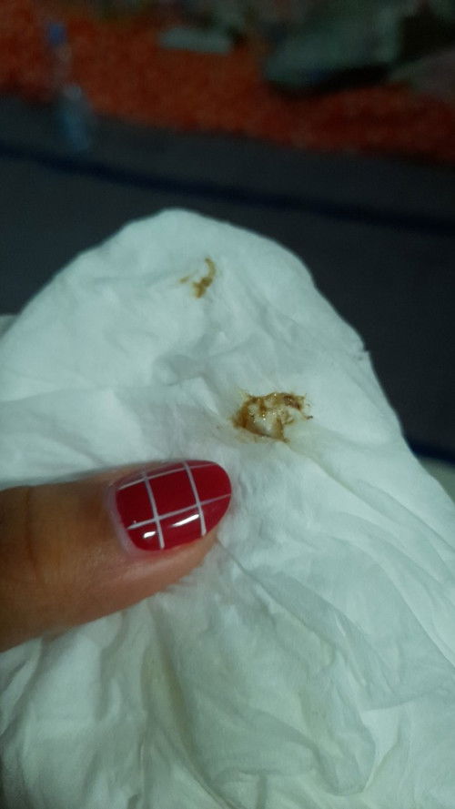 apakah flek usia 6 minggu wajar