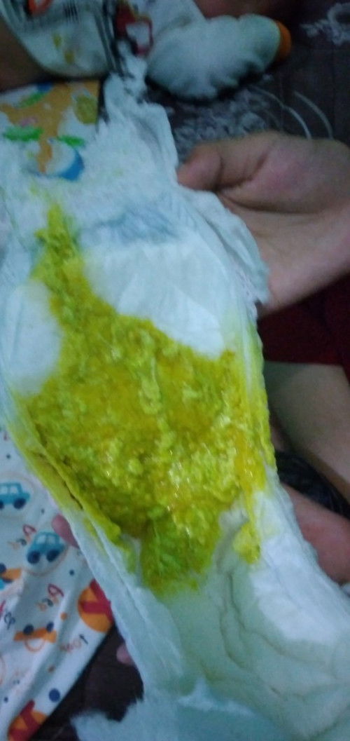 Apakah di sebut diare?