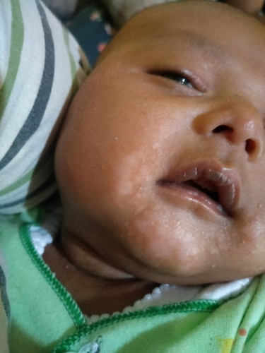 Putih putih