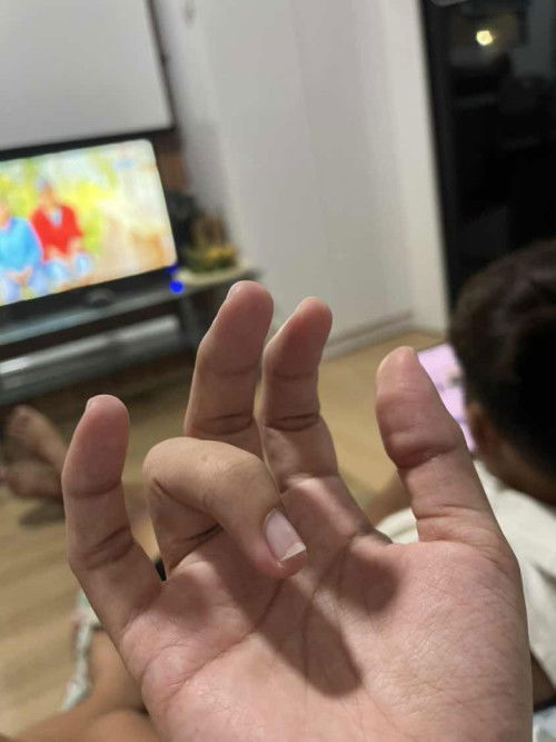 Pamamanhid ng daliri