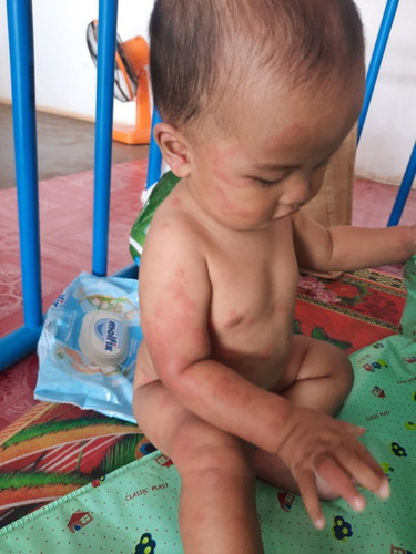 ลูกชายไม่รุ้แพ้อะไร