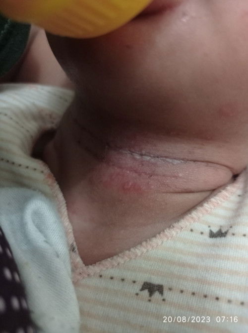 Bund mau tanya leher anak aku kyak gini kenapa ya pakai apa ya