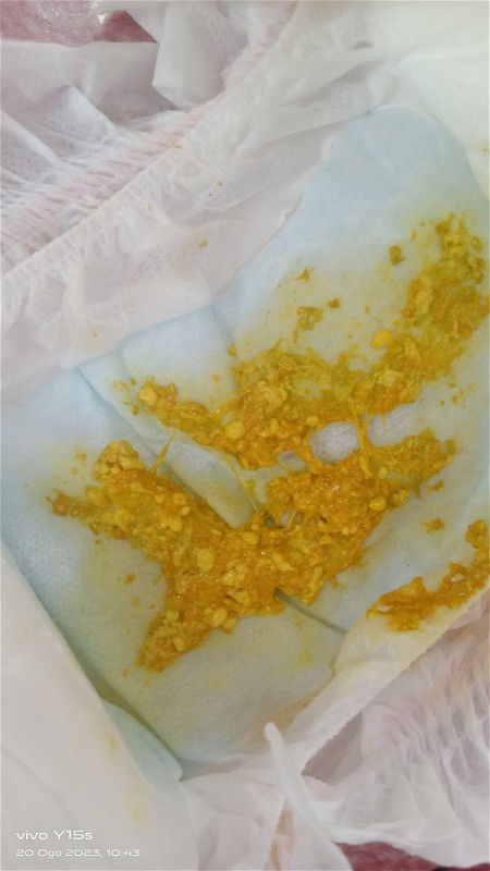 Najis wrna kuning berbiji-biji